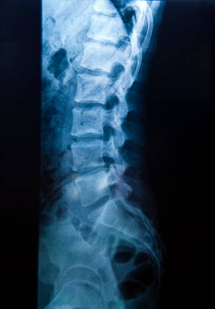 Human Back with visible pain.