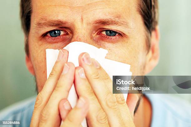 Closeup Portrait Of Red Eyed Man Holding Tissue To His Nose Stock Photo - Download Image Now