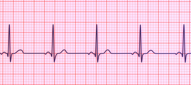 A normal electrocardiogram ECG, 3D illustration displaying the electrical activity of the heart in a healthy individual.
