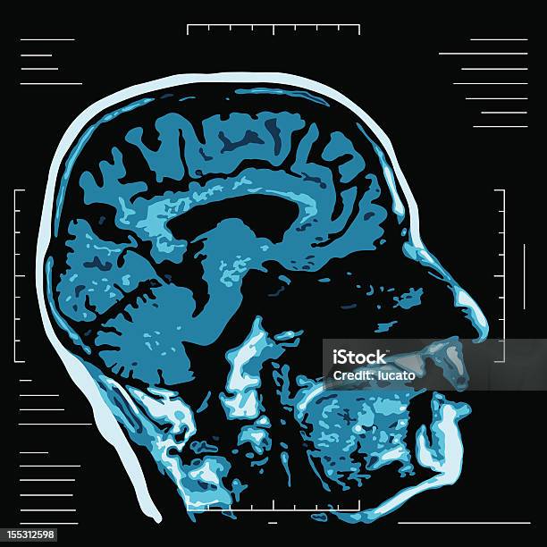 Mri に磁気共鳴 - MRI検査のベクターアート素材や画像を多数ご用意 - MRI検査, MRI装置, 医療スキャン装置