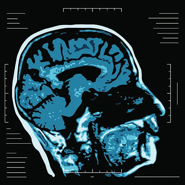 Vector illustration of MRI - Magnetic resonance