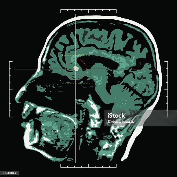 Mózgtarget - Stockowe grafiki wektorowe i więcej obrazów Obrazowanie magnetyczno-rezonansowe - Obrazowanie magnetyczno-rezonansowe, Skaner MRI, Diagnostyka obrazowa