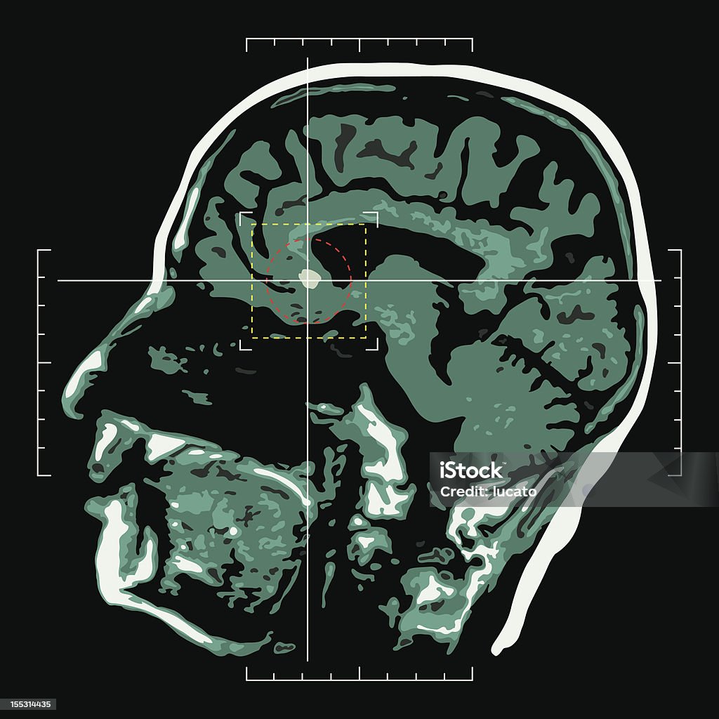 Cérebro-alvo - Vetor de Exame de ressonância magnética royalty-free
