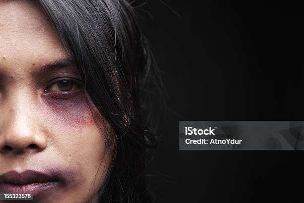 Domestic Violence Victim Stock Photo - Download Image Now - Women, Domestic Violence, Violence