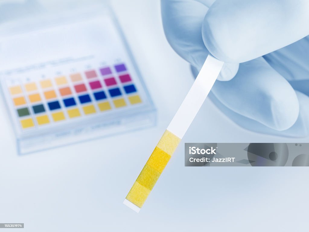 스트립형 of 산성도 종이 놓여 표본 - 로열티 프리 산도 값 스톡 사진
