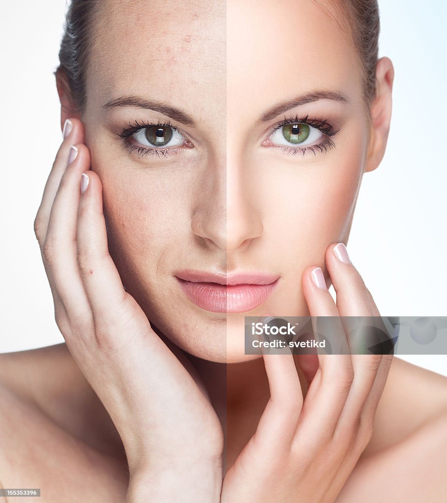 Vor und nach. - Lizenzfrei Menschliches Gesicht Stock-Foto