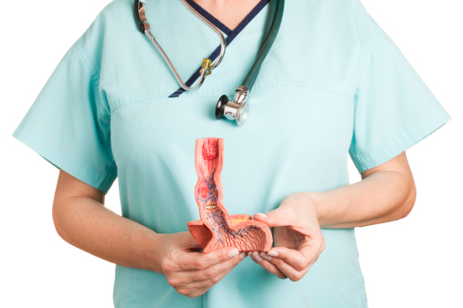 A nurse holding an anatomical model of human oesophagus.  The model shows the following illnesses: reflux oesophagitis, ulcus, Barrett’s Ulcer, Oesophageal carcinoma, Oesophageal varices and hiatal hernia. White background.