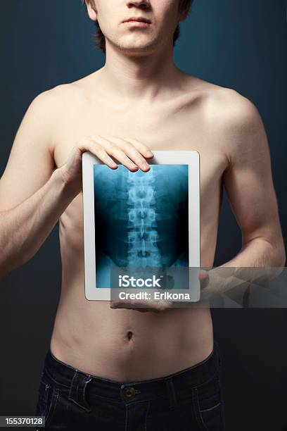 Tablet Rtg - zdjęcia stockowe i więcej obrazów Operacja chirurgiczna - Operacja chirurgiczna, Technologia, Anatomia człowieka