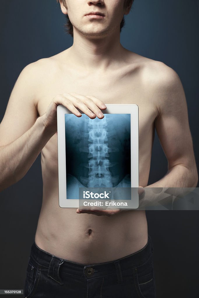 Tablet Digital & raio-X - Foto de stock de Cirurgia royalty-free