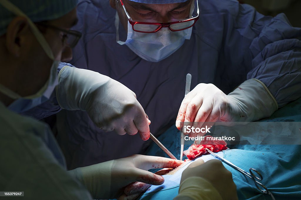 Doctor performing surgery parotid tumor surgery. Surgeon Stock Photo