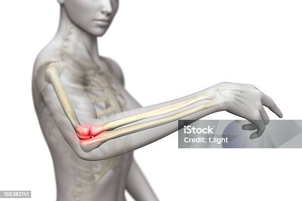 Tennis Elbow Stock Photo - Download Image Now - Elbow, Pain, Anatomy