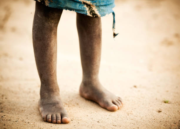 istock The Dusty Feet of an African Boy 155384841