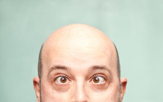 Bald man is so amazed he looks cross-eyed.