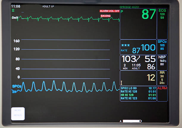 Close-up of intensive care unit monitoring screen intensive care unit monitor monitoring equipment stock pictures, royalty-free photos & images