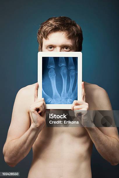 Tableta Digital Rayos X Foto de stock y más banco de imágenes de Abdomen - Abdomen, Abdomen humano, Adulto