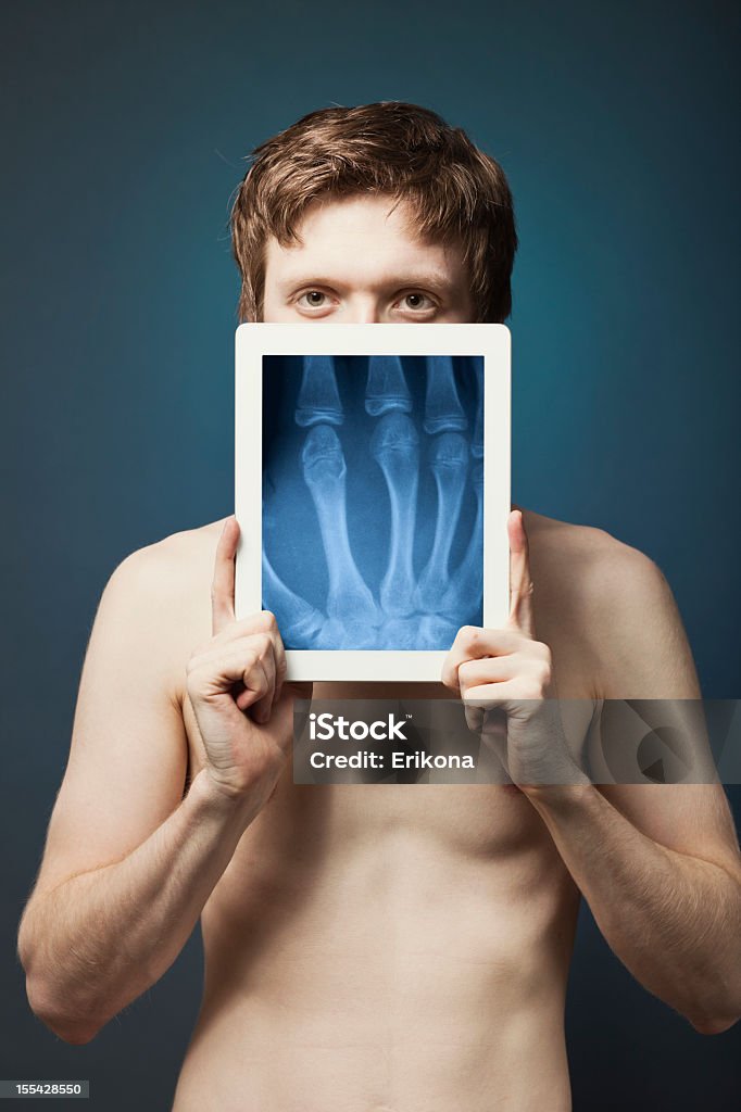 Tablet Digital & raio-X - Foto de stock de Abdome royalty-free