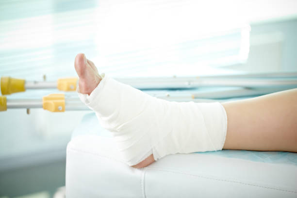 istock Sprain of a foot 155432968