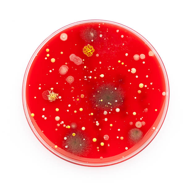 micro -物質 - petri dish bacterium colony laboratory ストックフォトと画像