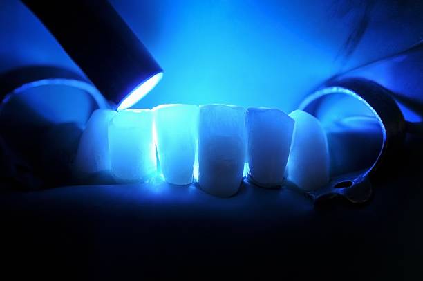 Dental Treatment stock photo