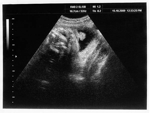 istock child on the ultrasound image 155451756