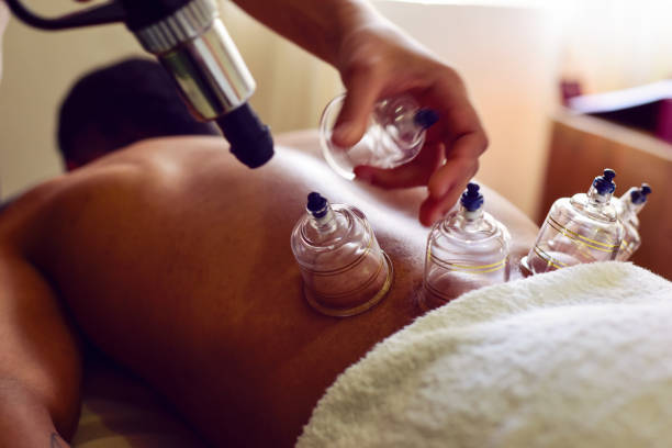 istock Cupping therapy getting in spa salon. beauty treatment concept. 1554803285