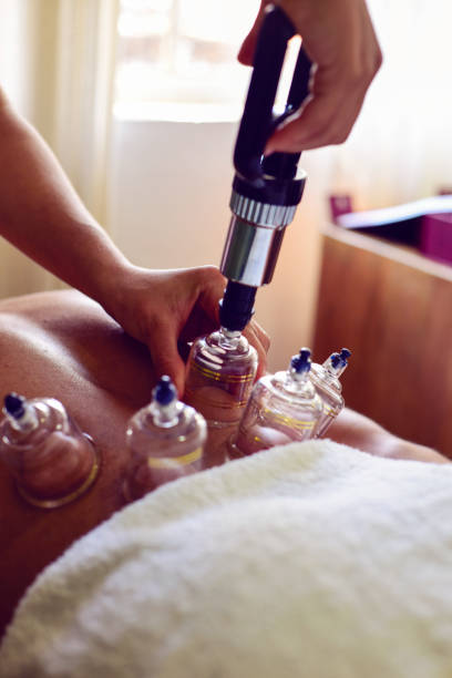 istock Multiple vacuum cups, medical cupping therapy on human body 1554803848