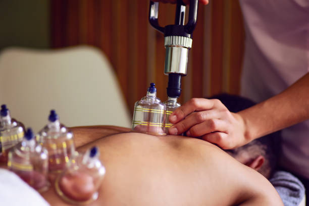 istock Multiple vacuum cups, medical cupping therapy on human body 1554804413