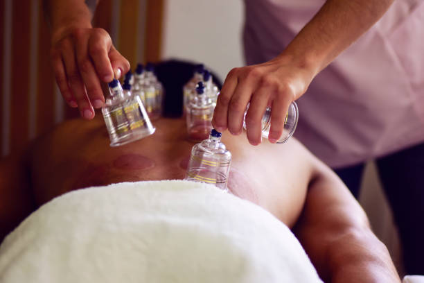 istock Medical cupping therapy on human body, close up cupping, Multiple vacuum cups 1554804936