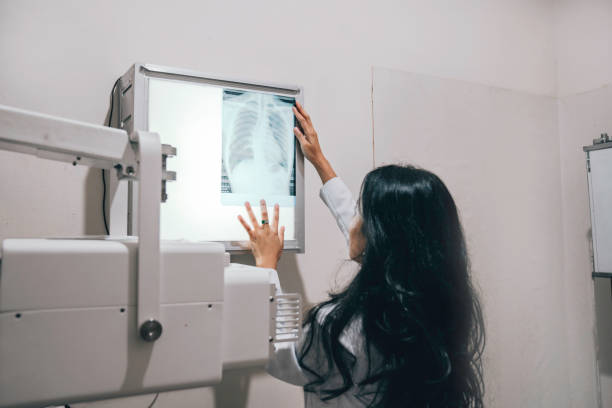 istock female doctor analyzing lung x-ray film in the lab 1554925007