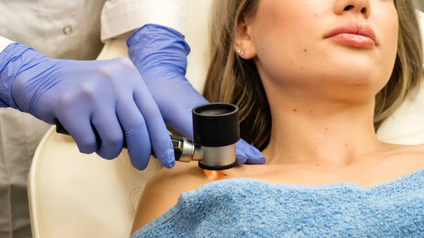 Dermatologist examines moles and birthmarks stock photo
