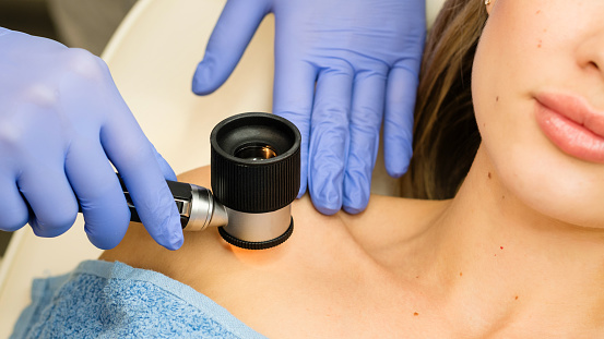 Dermatologist examines patient's birthmark with dermatoscope. Mole check. Dermoscopy