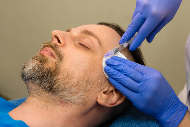 istock Mesotherapy rejuvenation injection for man 1555133582