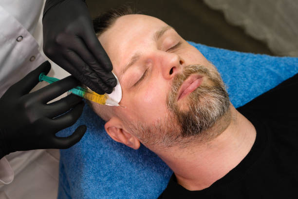 istock PRP therapy and plasma lift treatment 1555245355