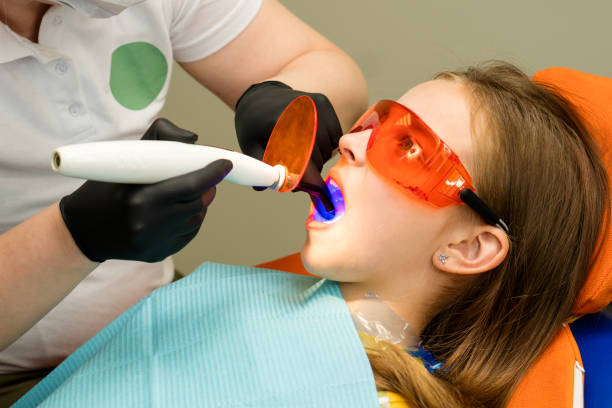 Dental polymerization UV lamp in oral cavity stock photo