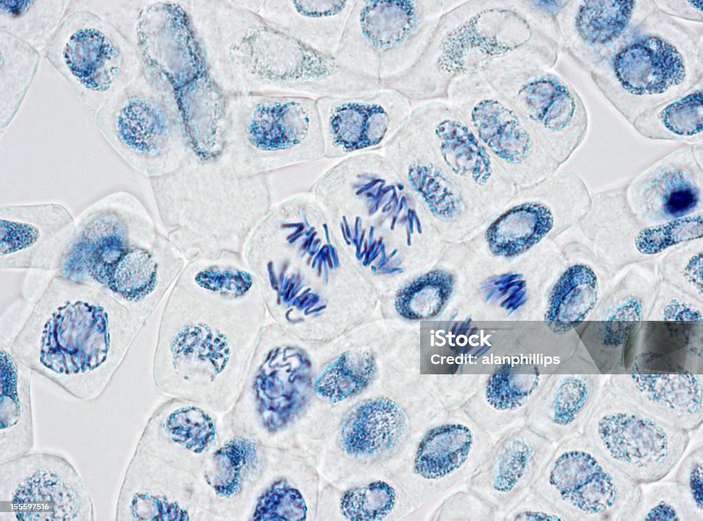 Microscope image of plant cells with three nuclei in anaphase  Mitosis Stock Photo
