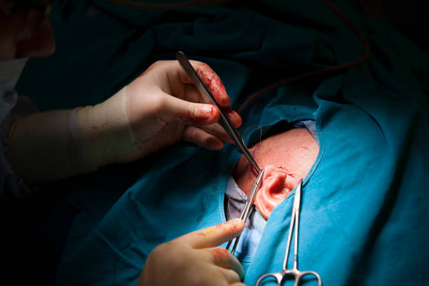 Doctor stitching up the patient stock photo