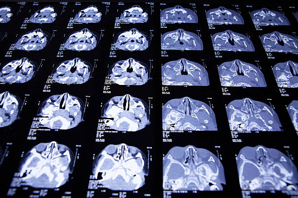 testa radiografia - mri scan cat scan machine x ray brain foto e immagini stock