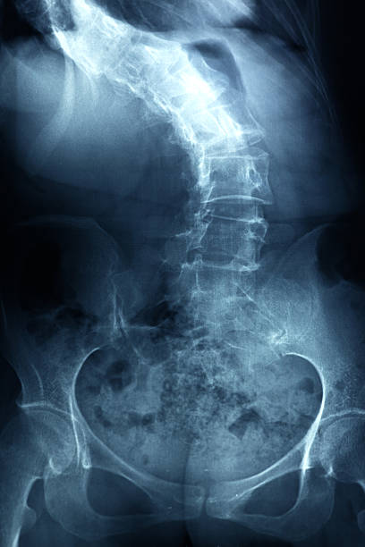 рентгеновское изображение человека позвоночника - human spine human bone human vertebra rib cage стоковые фото и изображения