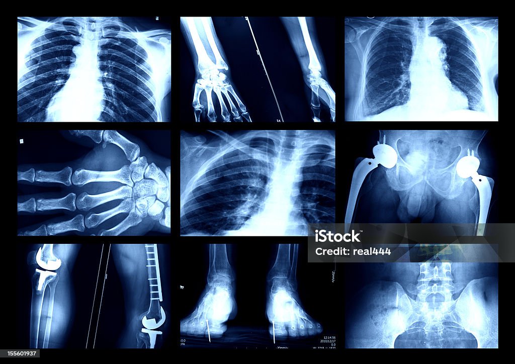 x-ray - Foto de stock de Anatomia royalty-free