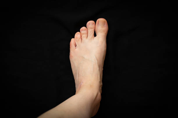 The left leg of the girl stands on a black background, view from top to bottom, part of the body stock photo