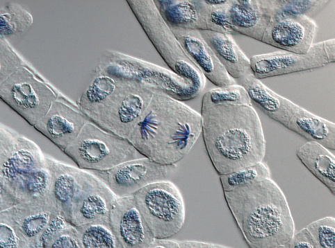 Squash preparation of stained onion root tip cells showing various stages of mitosis. Differential interference contrast optics on a Leica microscope, Image taken with the X40 objective lens.  Depth of focus is extremely shallow (just a few microns).  Differential interference contrast results in an optical slice horizontally through the specimen providing maximum possible resolution at this magnification and good contrast. Chromatic abberation is inevitable in light microscopy, but has been kept to a minimum in this image.