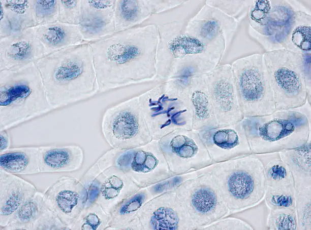 Photo of Plant cells stained for nuclei with one cell in metaphase