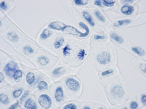 Squash preparation of  onion root tip cells stained to reveal chromosomes,  Bright field illumination, light microscopy.  This image was taken with the X40 objective lens.  Depth of focus is extremely low at this magnification.  Smaller apertures give greater depth of focus, but image quality deteriorates and resolution is greatly reduced.  The aperture in this image was optimised for contrast and resolution. Chromatic abberation is inevitable in light microscopy, but has been kept to a minimum in this image.