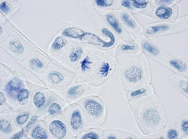 Photo of Plant cells stained for nuclei with one in anaphase