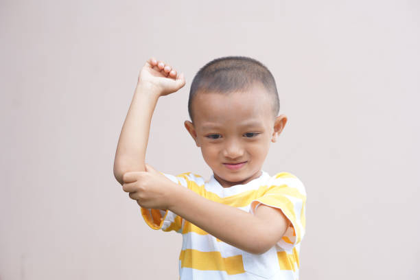 istock The boy has itchy skin on the arm. 1559569781