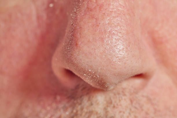 istock Closeup of male nose with light beard 1560022559