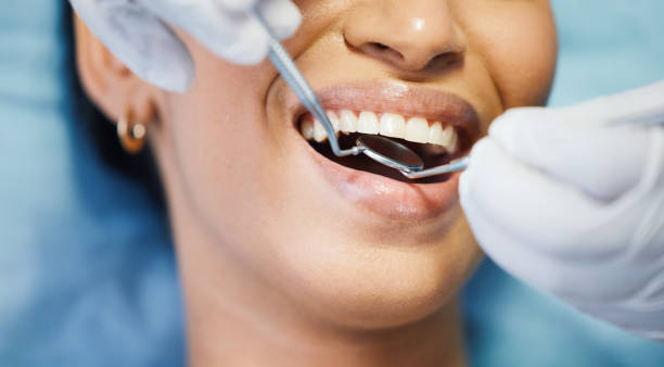 Dentist, mirror and hands, patient mouth and medical tools, surgery and dental health. Tooth decay, healthcare and people at orthodontics clinic for oral care, metal instrument and gingivitis stock photo