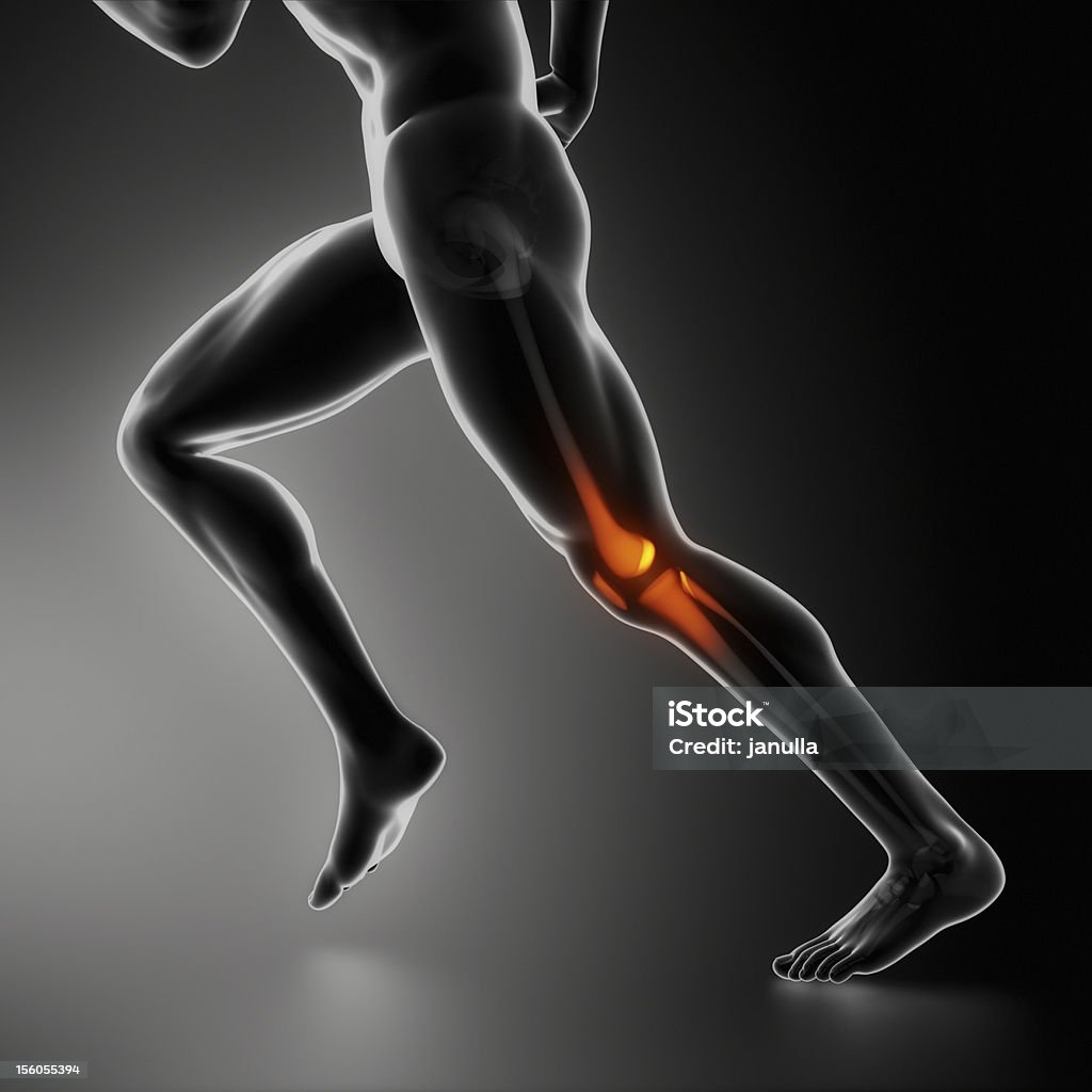 Deportes lesión de la rodilla concepto de rayos x - Foto de stock de Adulto libre de derechos