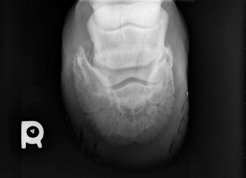 An EXCELLENT medical scan taken by a radiologist of a horse's right hoof; imagery was required to make proper diagnosis and determine the extent of the mare's injuries.