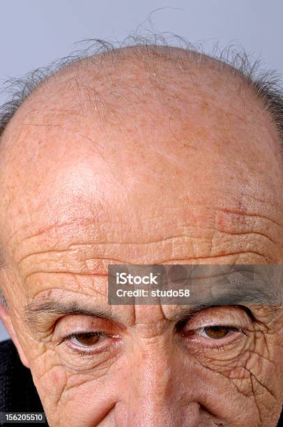 Calvizie - Fotografie stock e altre immagini di Adulto - Adulto, Alopecia areata, Close-up